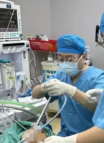 4天接诊鱼刺卡喉